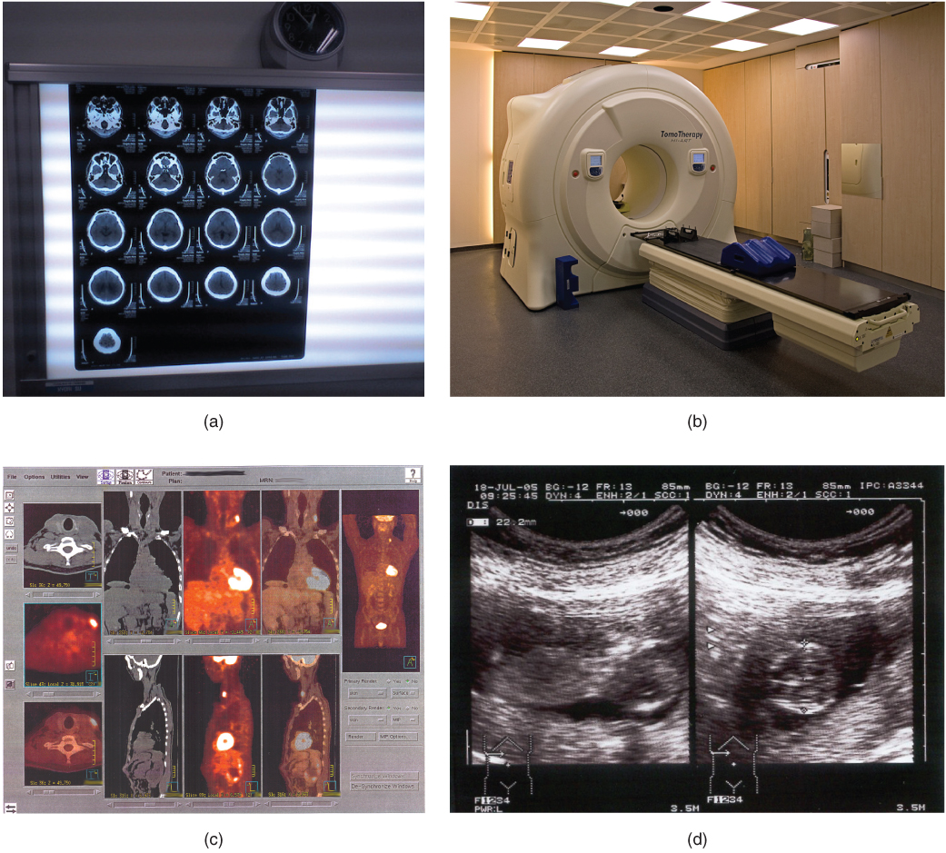 These Photos Shows Four Types Of Imaging Equipment Photo A The