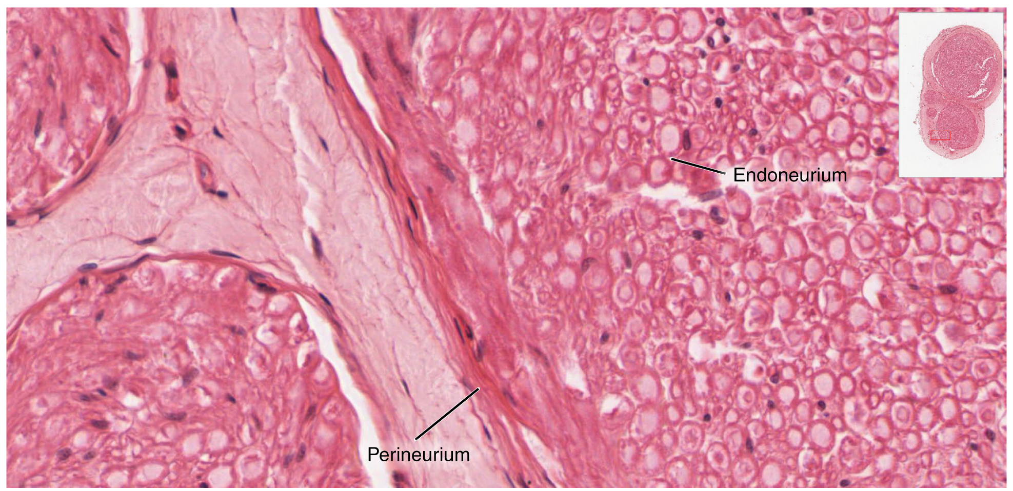 This micrograph shows a magnified view of the nerve. The perineurium