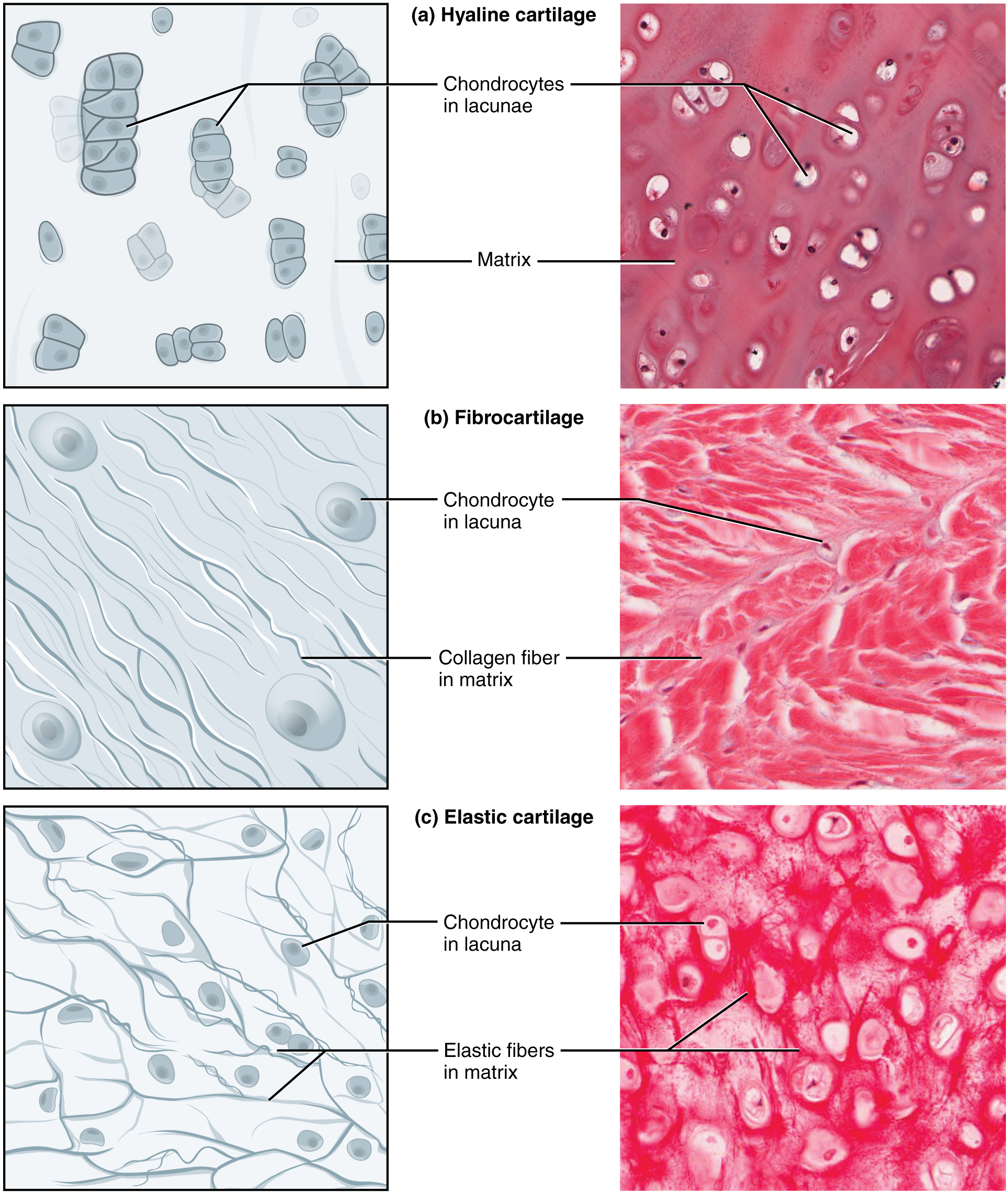 Part A of this diagram is a drawing and a micrograph of hyaline