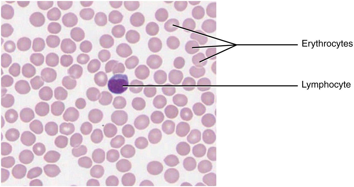 This micrograph of a blood smear shows a group of red blood cells and a
